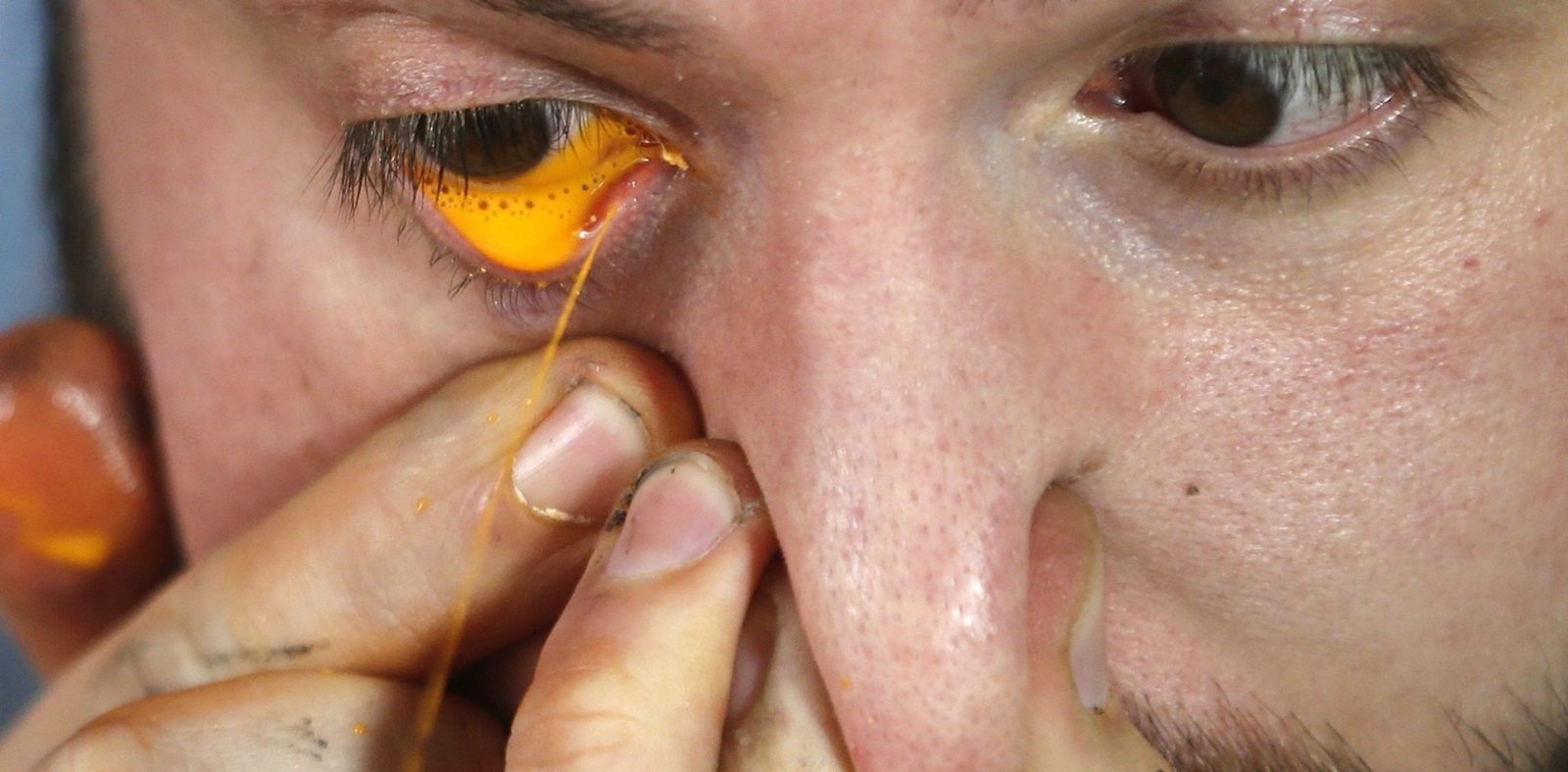 Can you go blind from getting paint in your eyeExperts Advice Painting Doctors