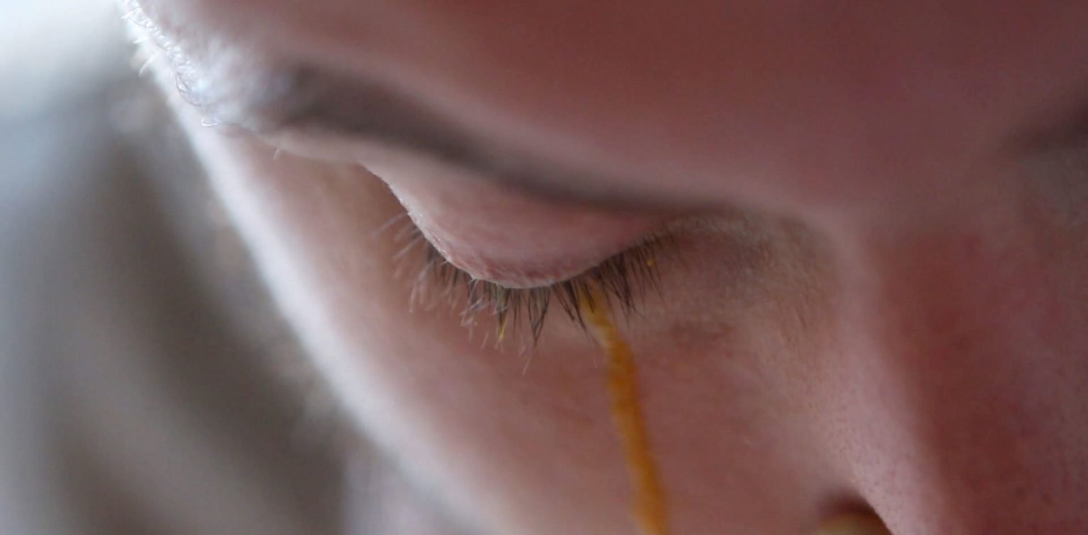 Can you go blind from getting paint in your eyeExperts Advice Painting Doctors